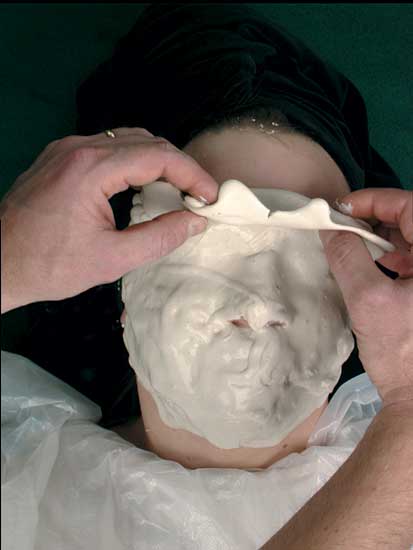 Moulage and Posmoulage Materials - Material slowly being peeled off face
